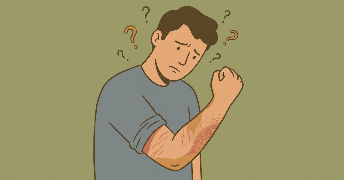 Entre picar y descamarse: cuando la piel pide un dermatólogo y no solo una crema