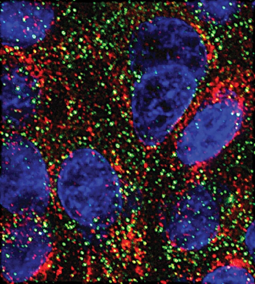 MicroARN probado en laboratorio frena el crecimiento de células pancreáticas